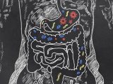 Digestive System Disorders Often Experienced